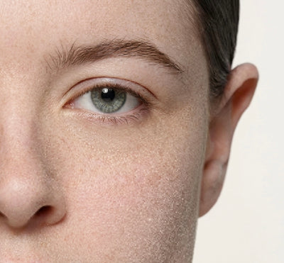 Dry Skin