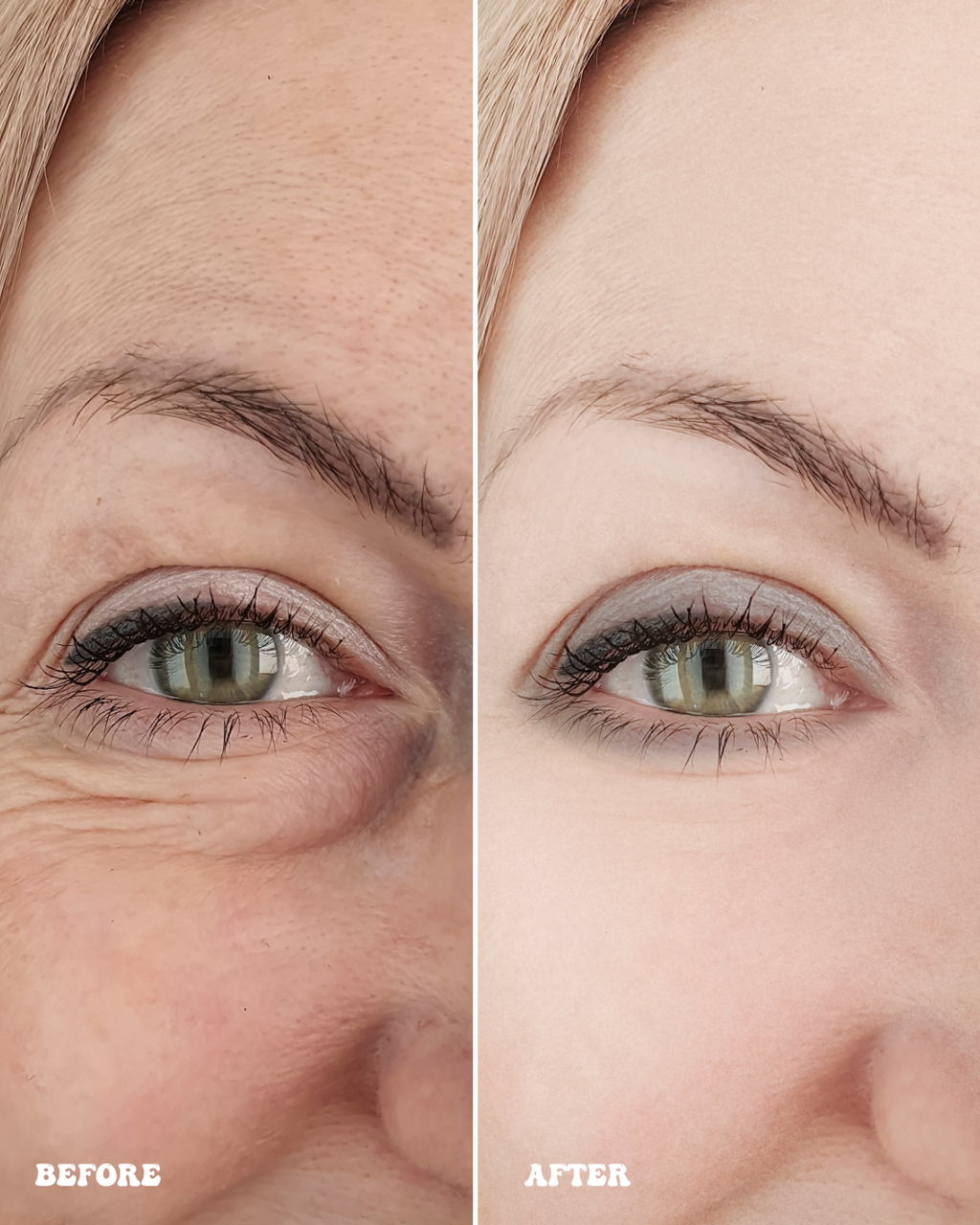 ANTI-AGING PEPTIDE SERUM