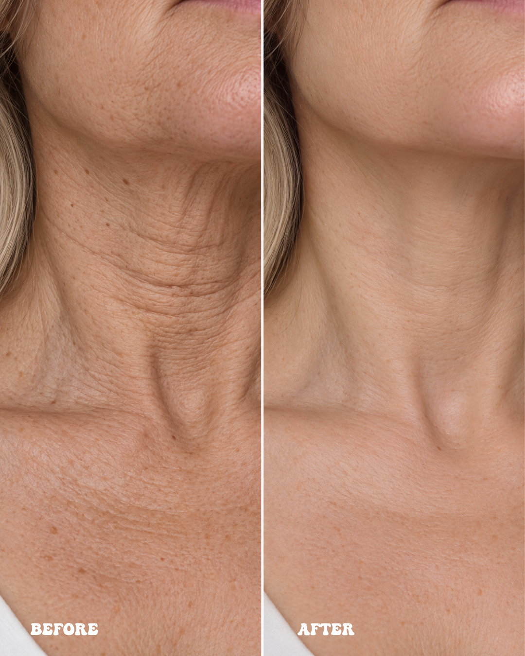 ANTI-AGING PEPTIDE SERUM